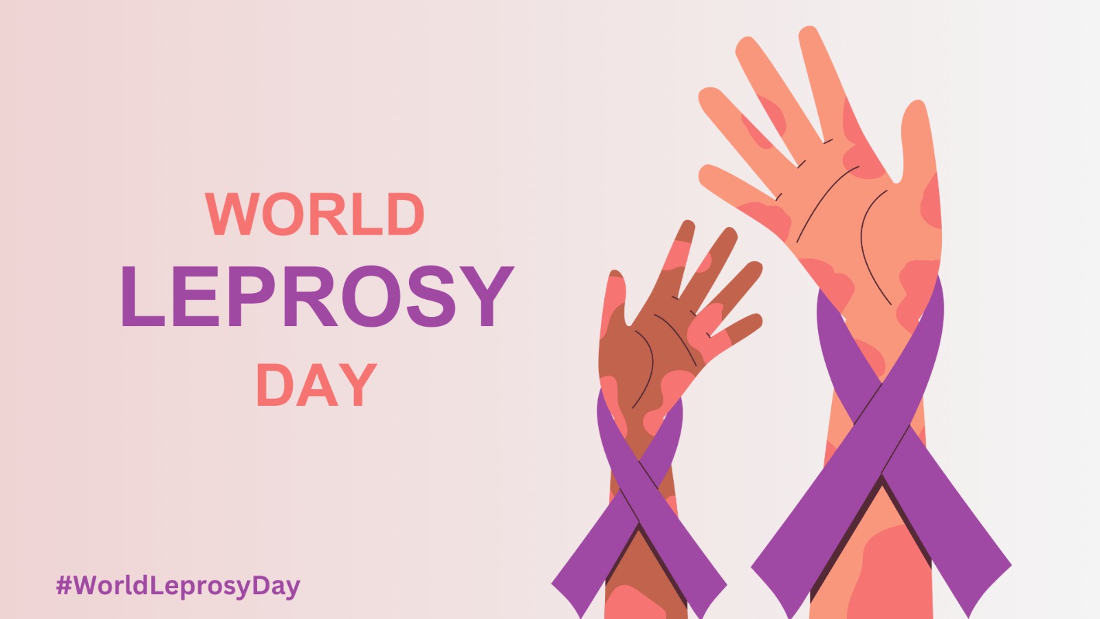World Leprosy Day: Can Early Treatment Stop Leprosy?